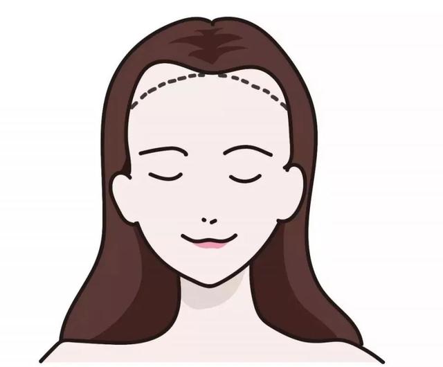 华美植发教你发际线过高怎么办