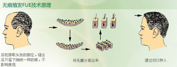 fue原理图jpg