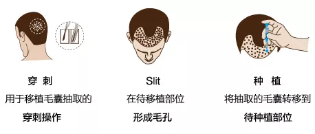 ֲ