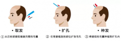 ֲѷð취