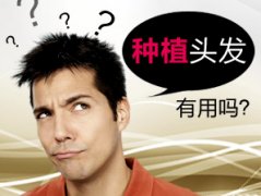 ֲ?