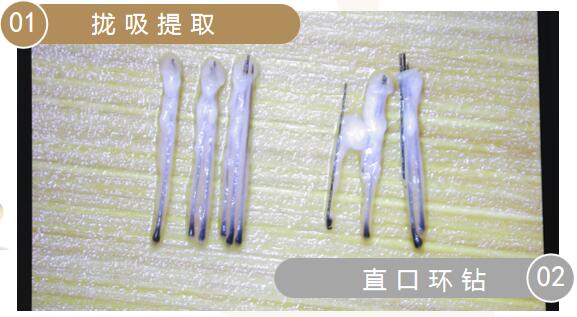 拢吸提取毛囊更完整无损伤